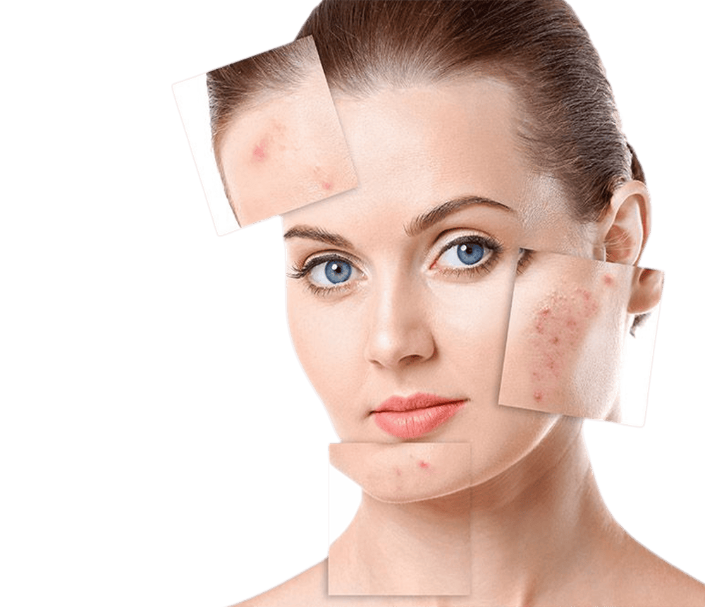 Skintreatment